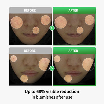 Cica Lactobacillus Spot Control SET