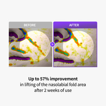 PLLA Age Reset Wrinkle Cream Plus