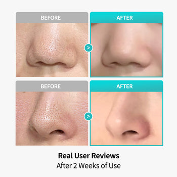 Centella Poreless Patch