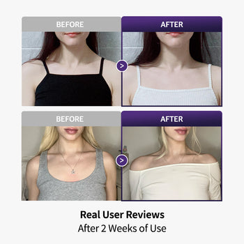 Trapezius Patch