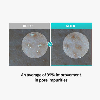 Centella Poreless Deep Cleansing Oil