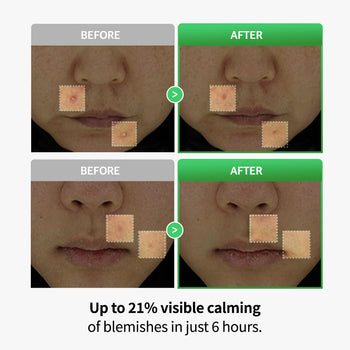 Cica Lactobacillus Spot Control Shot