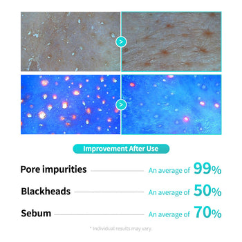 Centella Poreless Deep Cleansing Oil