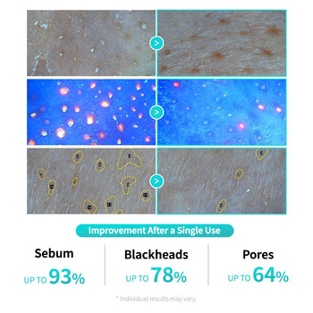 Centella Poreless Patch